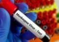 MPOX : केंद्र ने अंतरराष्ट्रीय हवाईअड्डों को क‍िया सतर्क