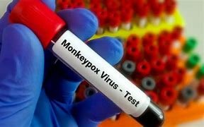 MPOX : केंद्र ने अंतरराष्ट्रीय हवाईअड्डों को क‍िया सतर्क